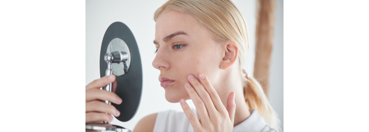 rimedi per le cicatrici da acne